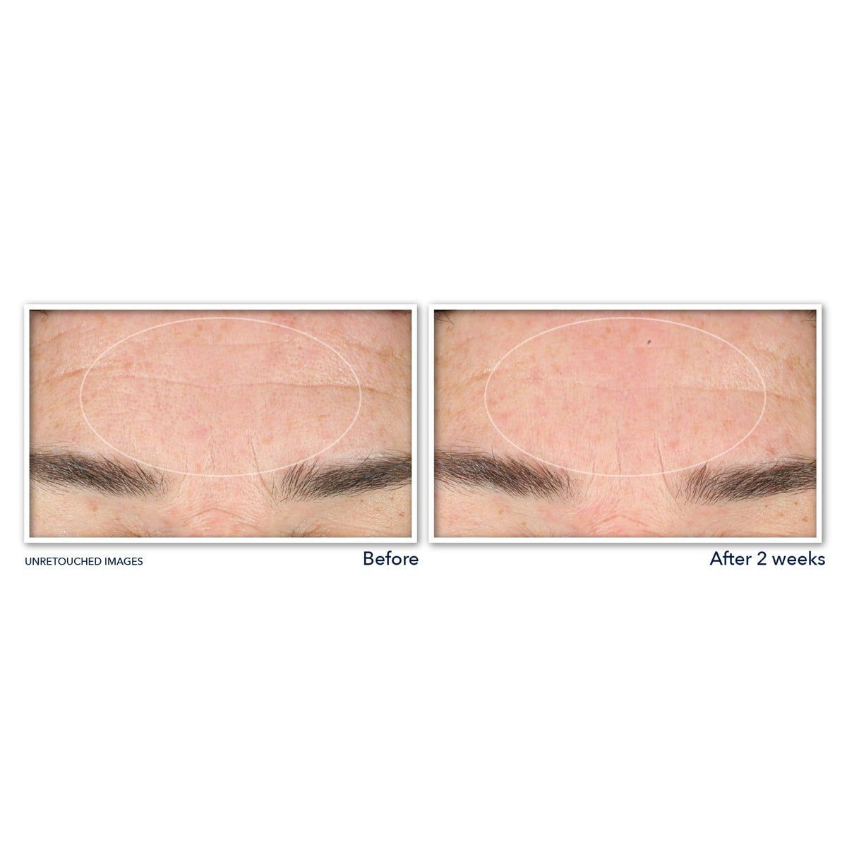 RoC close-up label highlighting key ingredients niacinamide and retinol