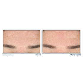 RoC close-up label highlighting key ingredients niacinamide and retinol