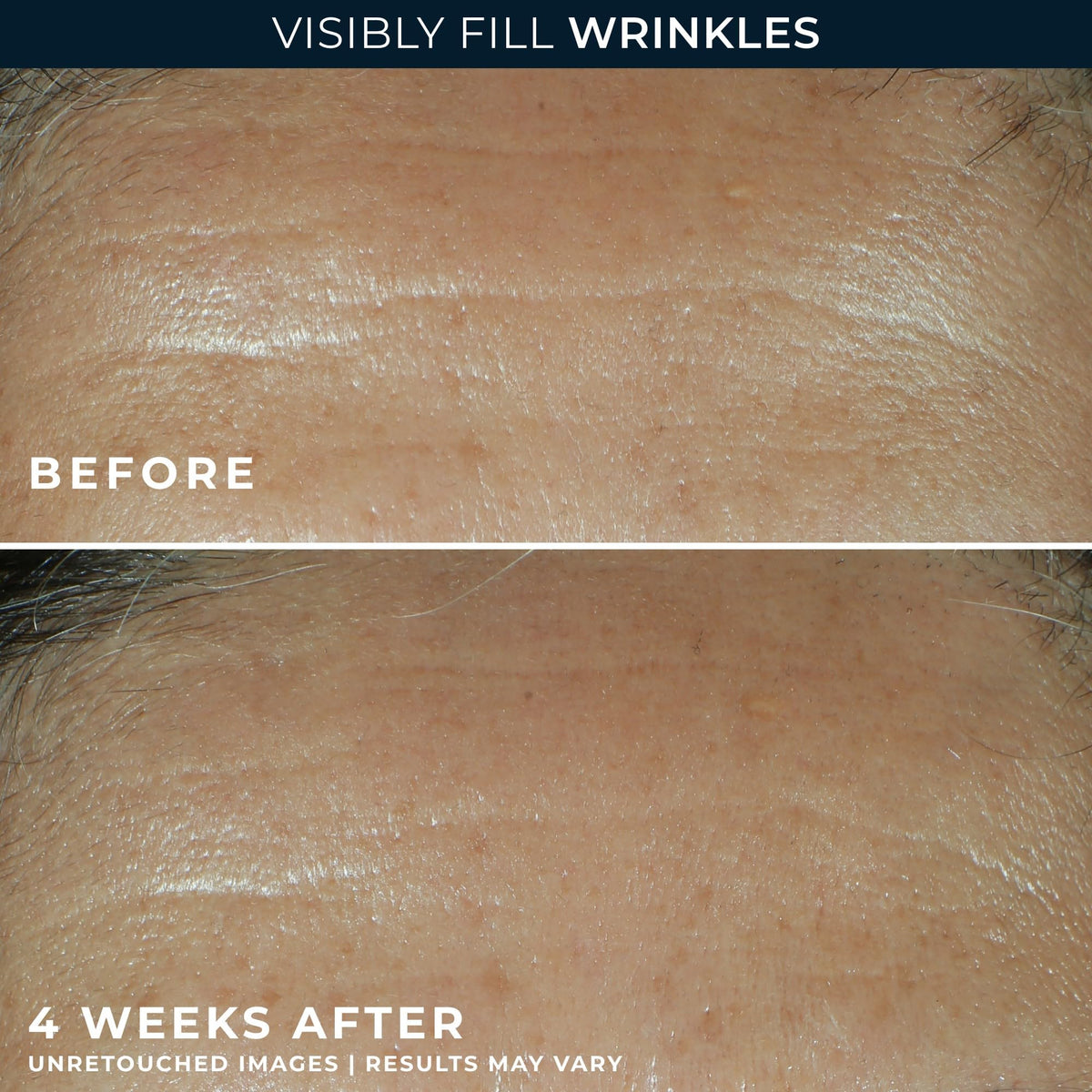 RoC close-up label listing retinol and hyaluronic acid benefits