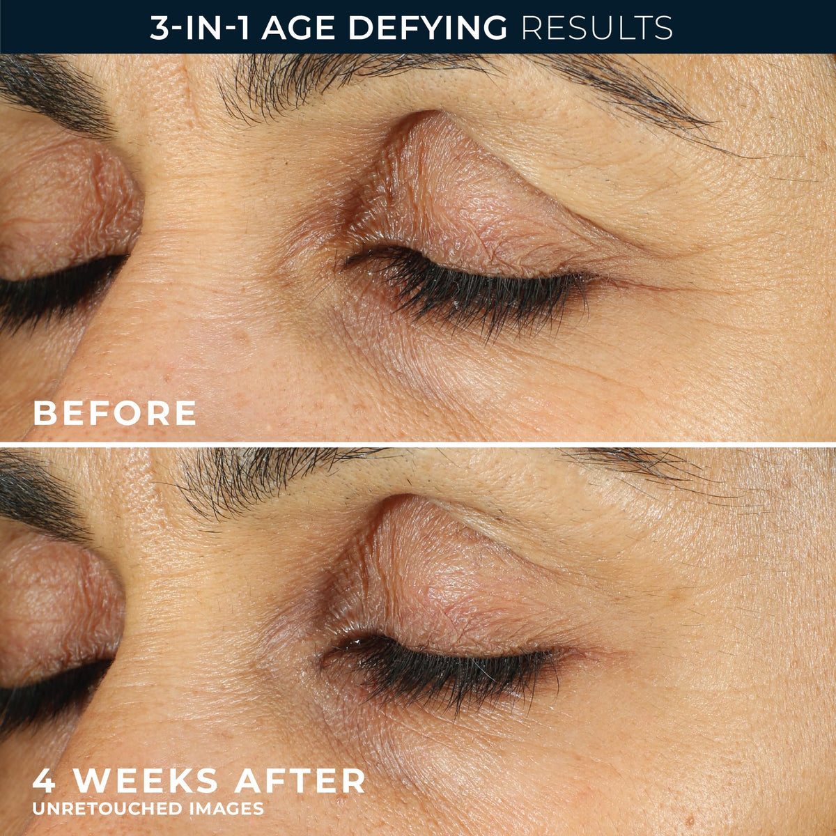 RoC illustrated before and after under-eye brightening results comparison