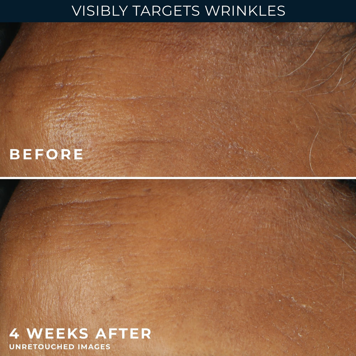RoC product staged in bathroom routine demonstrating morning protection benefit
