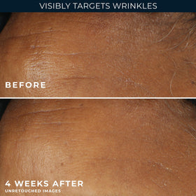RoC product staged in bathroom routine demonstrating morning protection benefit