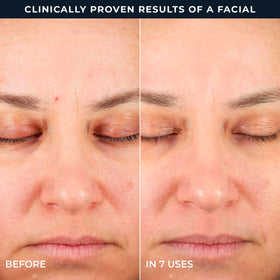 RoC product label listing key actives like clinical retinol and acids