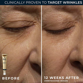 RoC eye cream applied beneath eye, reduces puffiness and brightens look