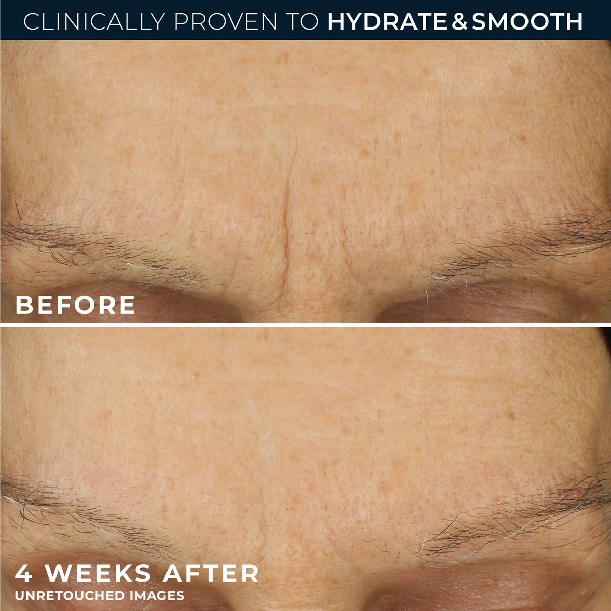 RoC ingredient label close-up spotlighting clinical retinol and hyaluronic acid