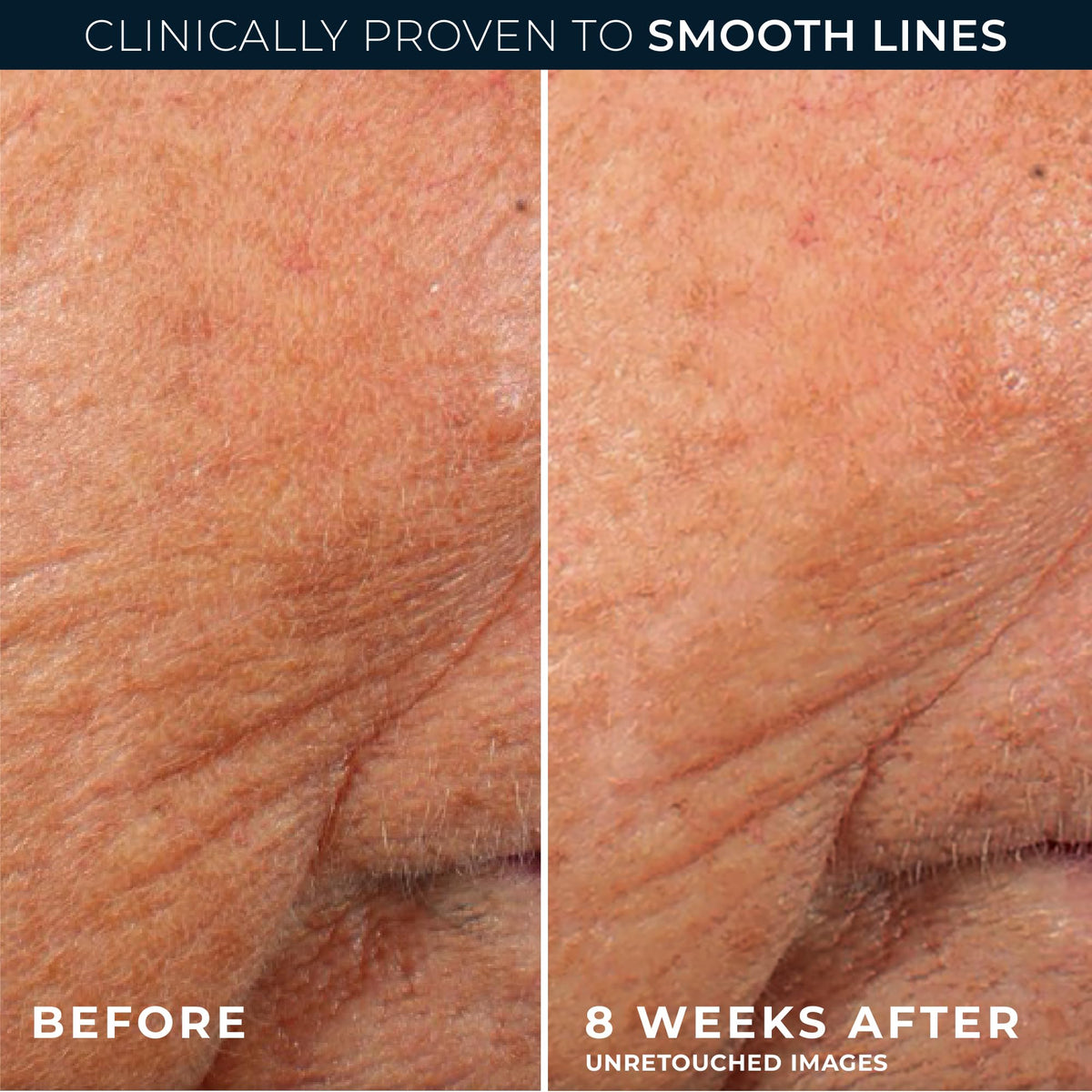 RoC packaging label and ingredients listing highlighting clinical retinol and ceramides