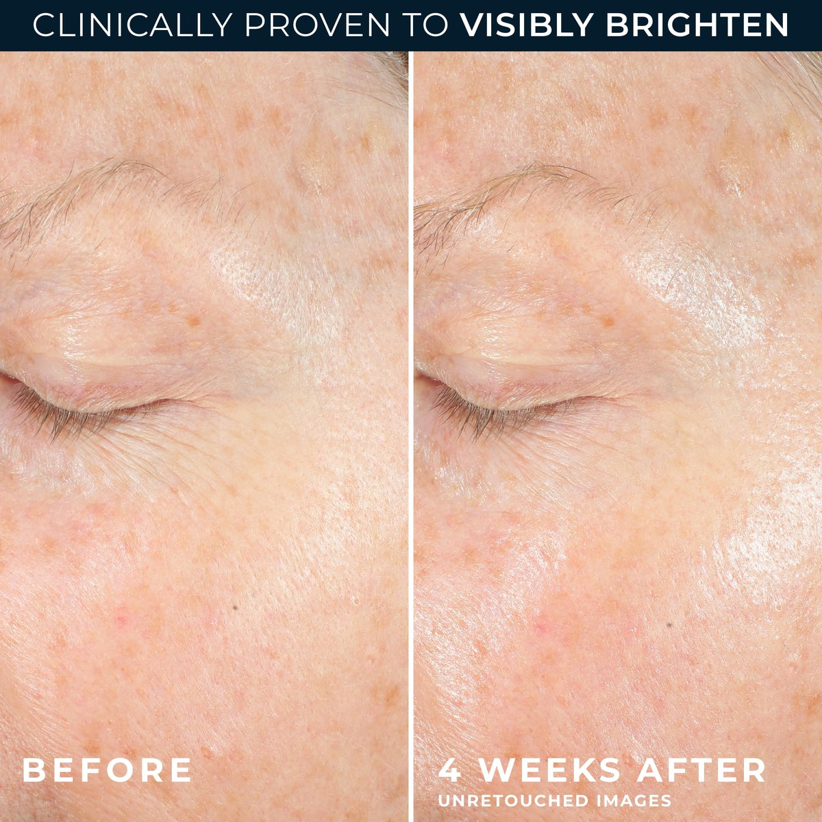 RoC application on hand demonstrating quick absorption and non-greasy finish