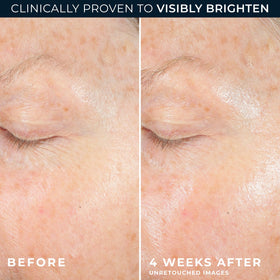 RoC application on hand demonstrating quick absorption and non-greasy finish