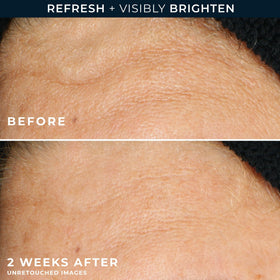 RoC lather in hand demonstrating gentle cleanse and oil removal