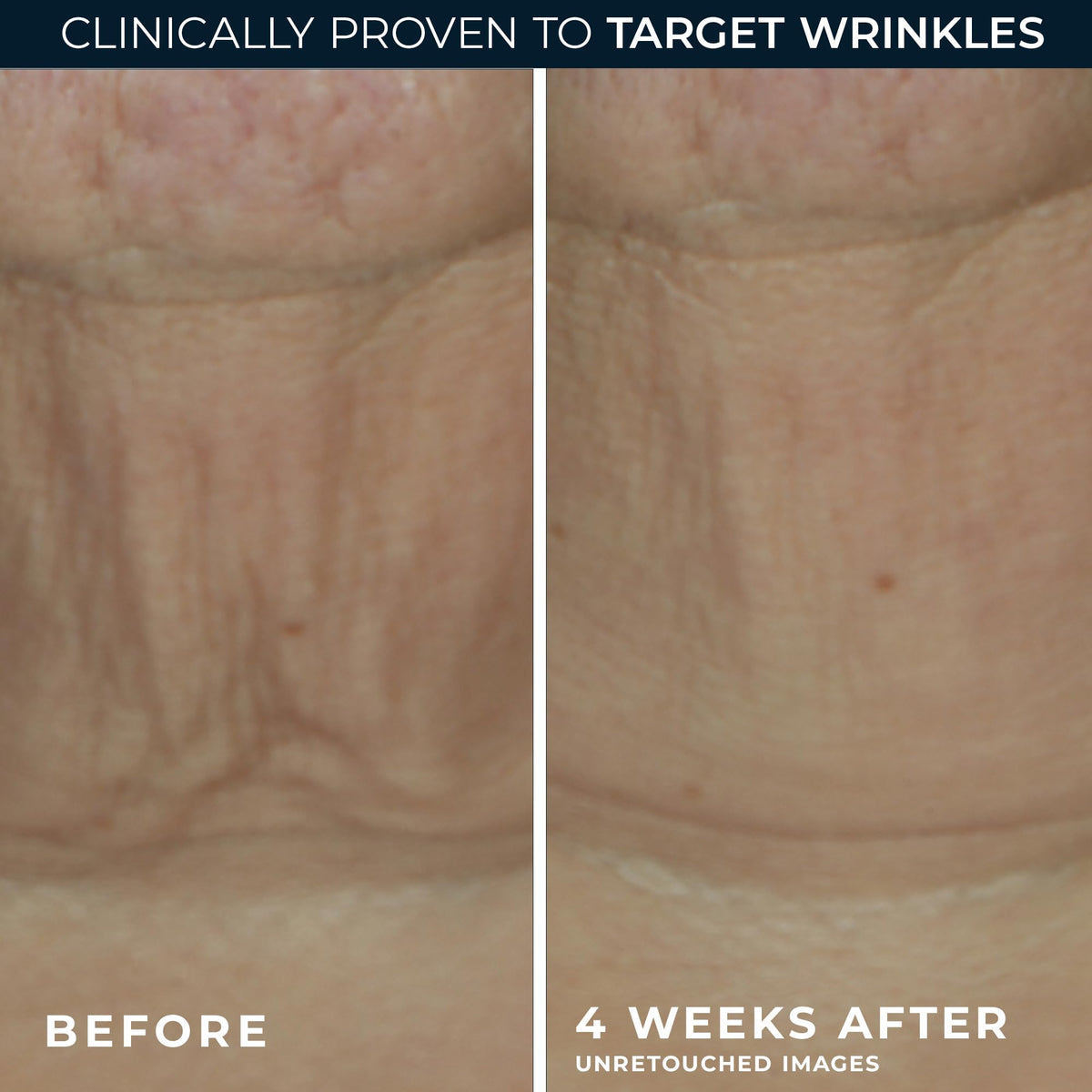 RoC serum stick used on neck to visibly firm and smooth skin