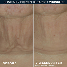 RoC serum stick used on neck to visibly firm and smooth skin