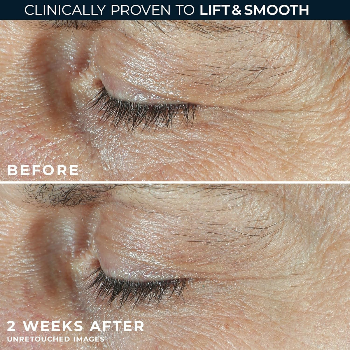 RoC under eye cream texture detail showing rich cream for hydration