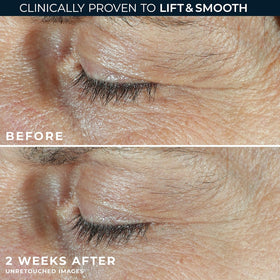 RoC under eye cream texture detail showing rich cream for hydration