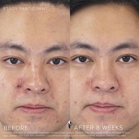 Rodan + Fields bottle in hand to show 0.76 fl oz scale and travel‑friendly convenience benefit