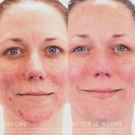Rodan + Fields texture closeup highlighting smooth consistency for easy, targeted application benefit