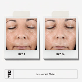 RODAN + FIELDS dispensing serum from pump for precise, mess-free application benefit