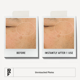 RODAN + FIELDS dispensing gel cream onto fingertip for easy overnight application