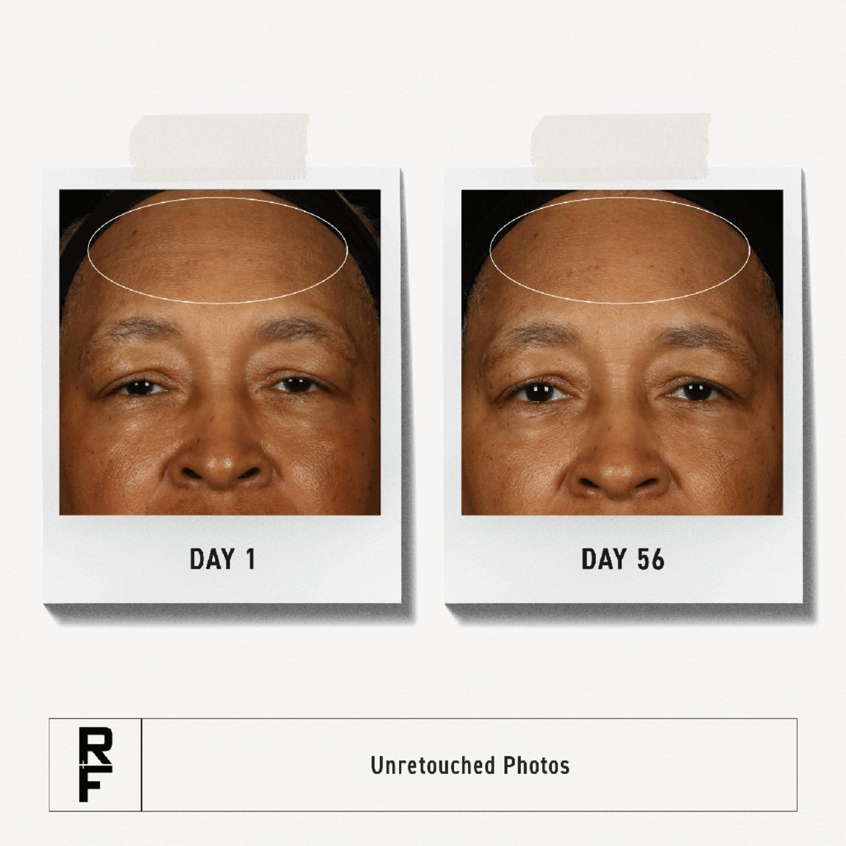 Rodan + Fields close-up of cream texture highlighting rich hydration and smooth finish