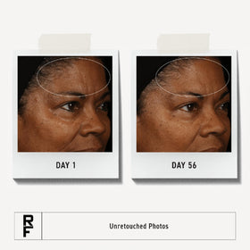 RODAN + FIELDS cream on hand demonstrating application and smoother-feeling skin