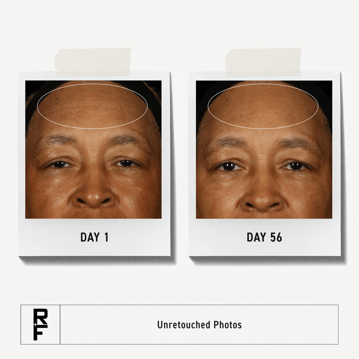 RODAN + FIELDS pump and cap detail for precise dispensing benefit