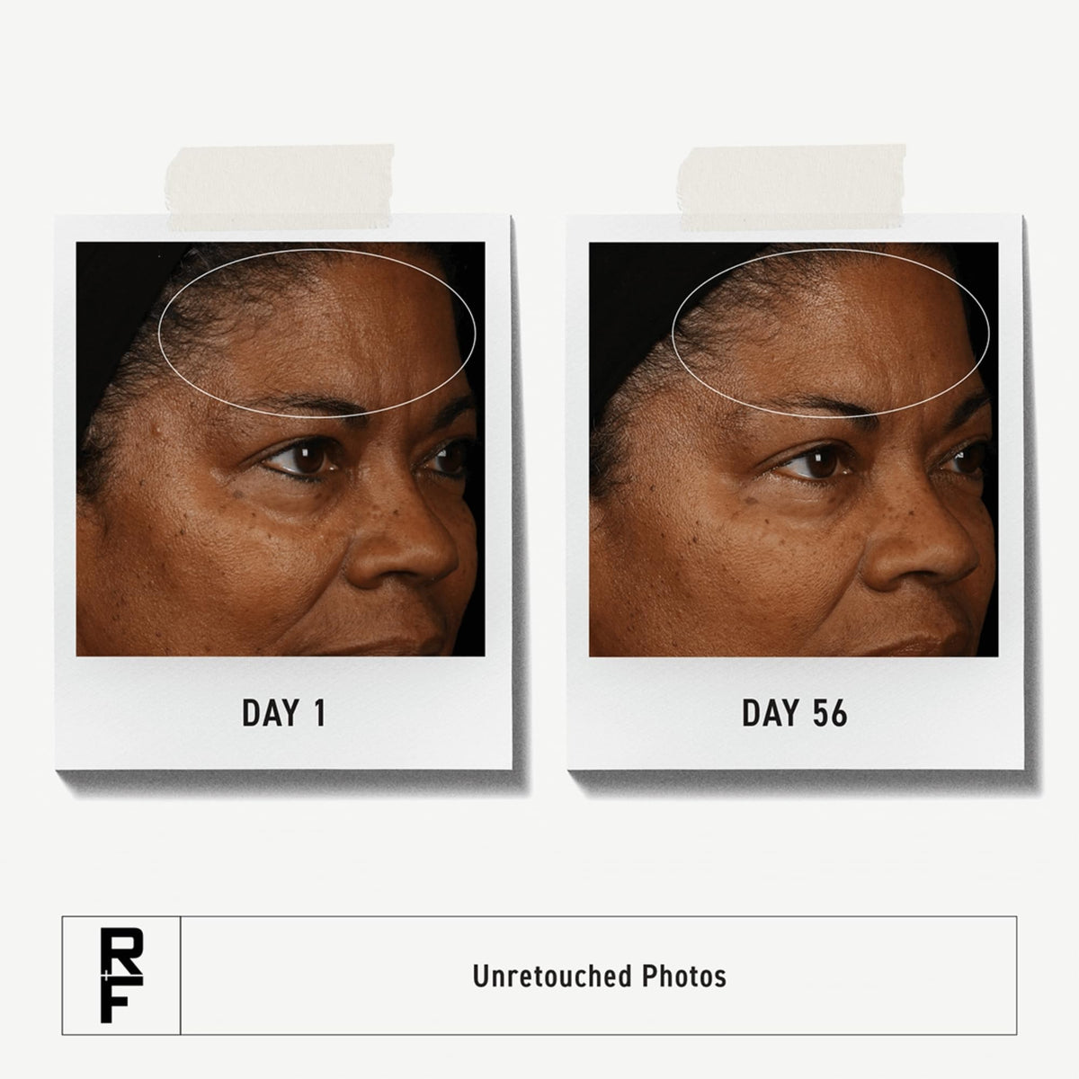 RODAN + FIELDS clay texture close-up showing gentle exfoliation benefit