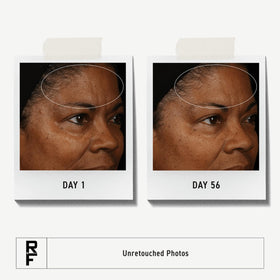 RODAN + FIELDS clay texture close-up showing gentle exfoliation benefit