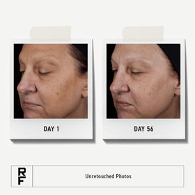 Rodan + Fields ingredients label close-up showing AHAs and BHAs benefit