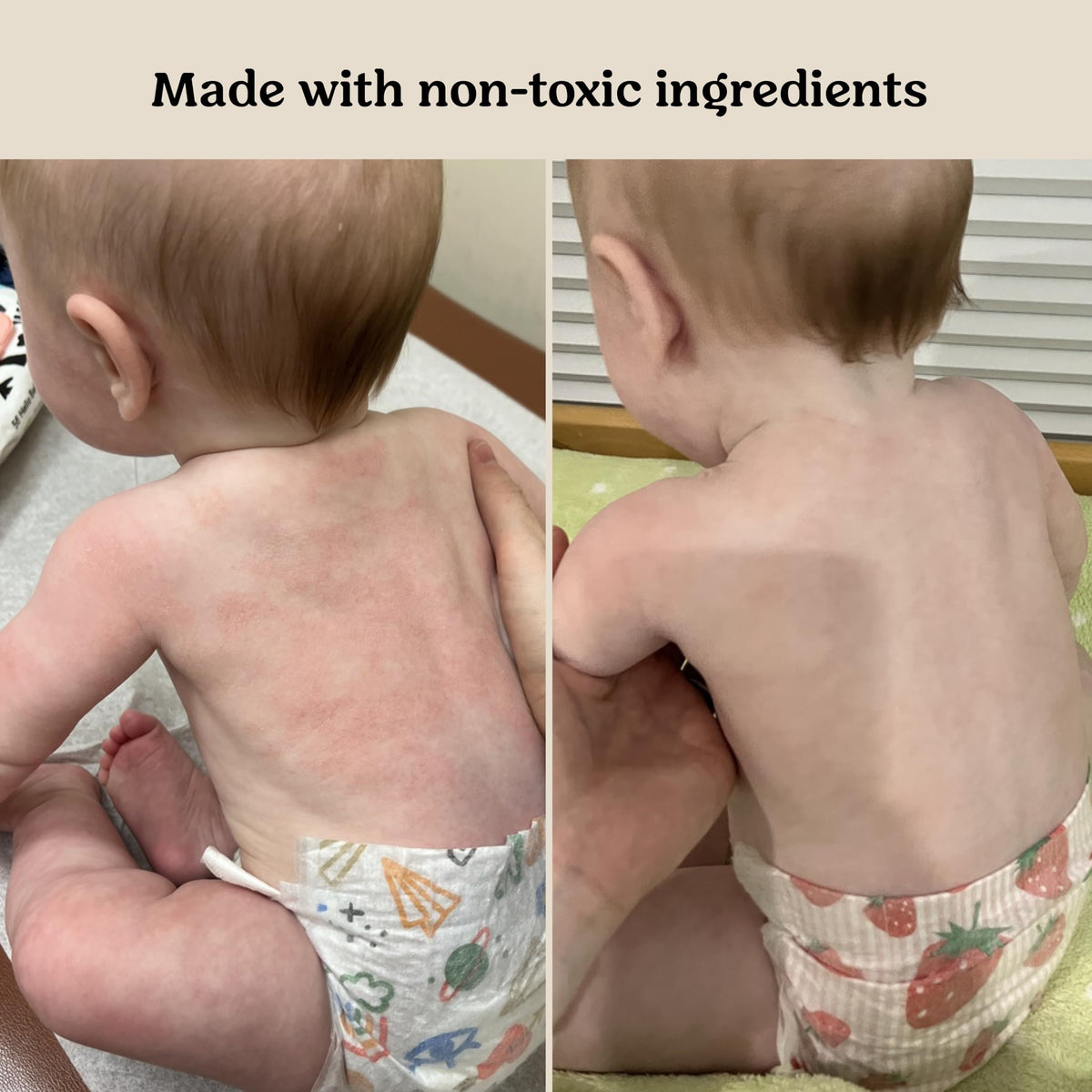 Roe Wellness ingredient label close-up showing EWG-verified safe ingredients