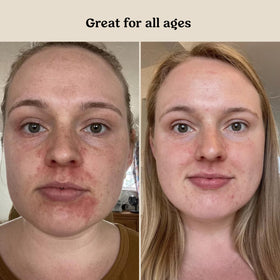 Roe Wellness serum staged in a nursery to portray calm daily skincare routine