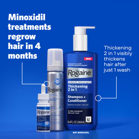 Rogaine before-and-after crown illustration indicating potential fuller-looking hair benefit