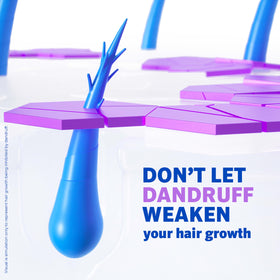 Scalp before and after visualization with Rogaine showing reduced visible flakes