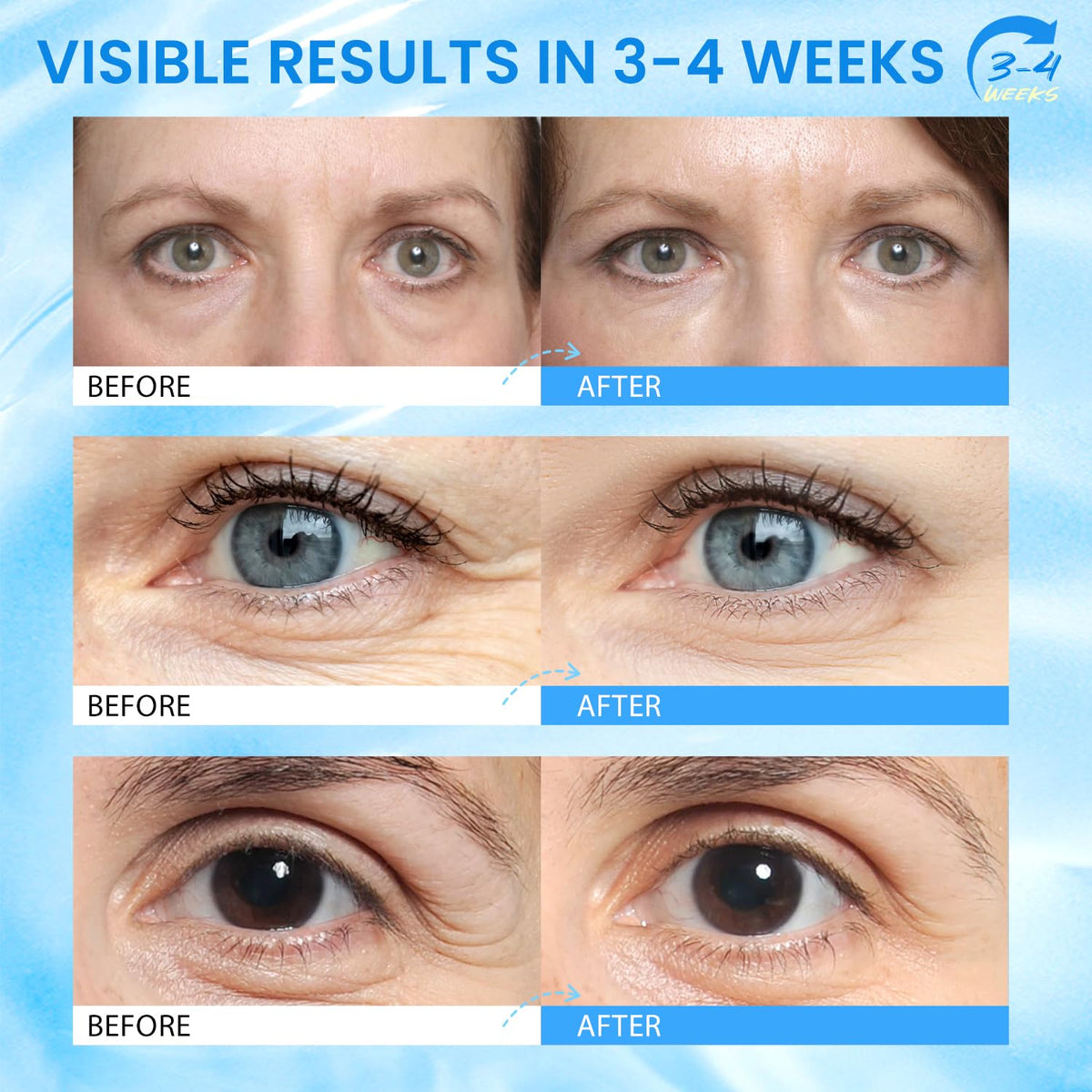 RONKIE applying stick under eye to reduce puffiness and brighten area