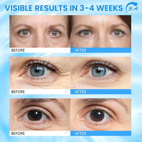 RONKIE applying stick under eye to reduce puffiness and brighten area