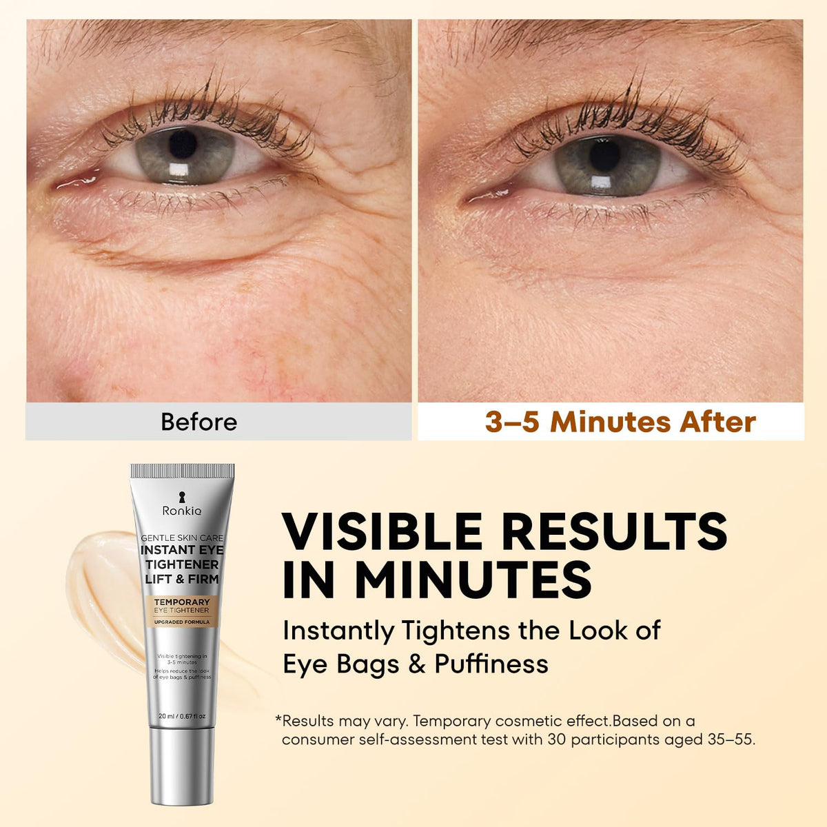 RONKIE open tube showing smooth gel texture to demonstrate lightweight spreadability