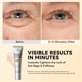 RONKIE open tube showing smooth gel texture to demonstrate lightweight spreadability