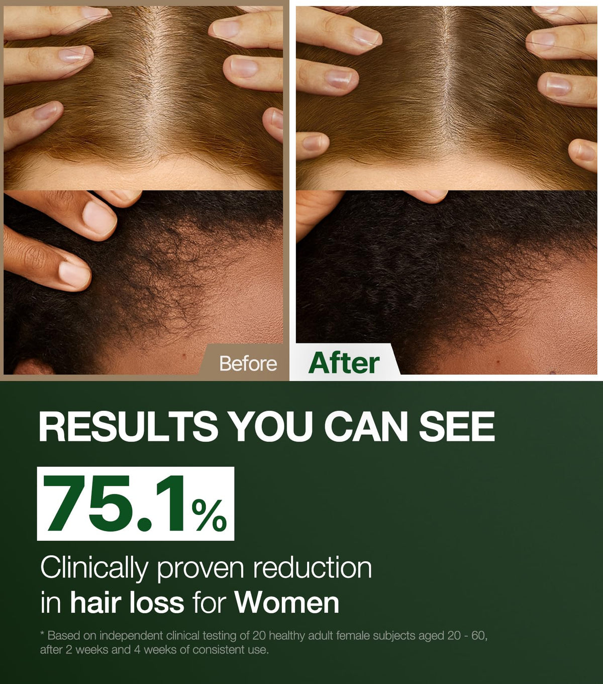 ROOTON label close-up highlighting ingredients and Dermatest compatibility benefit