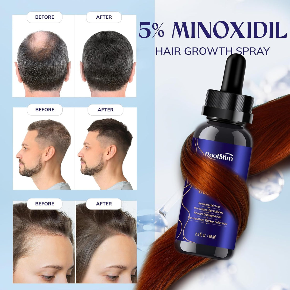 RootStim product texture close-up highlighting lightweight fast-absorbing formula benefit