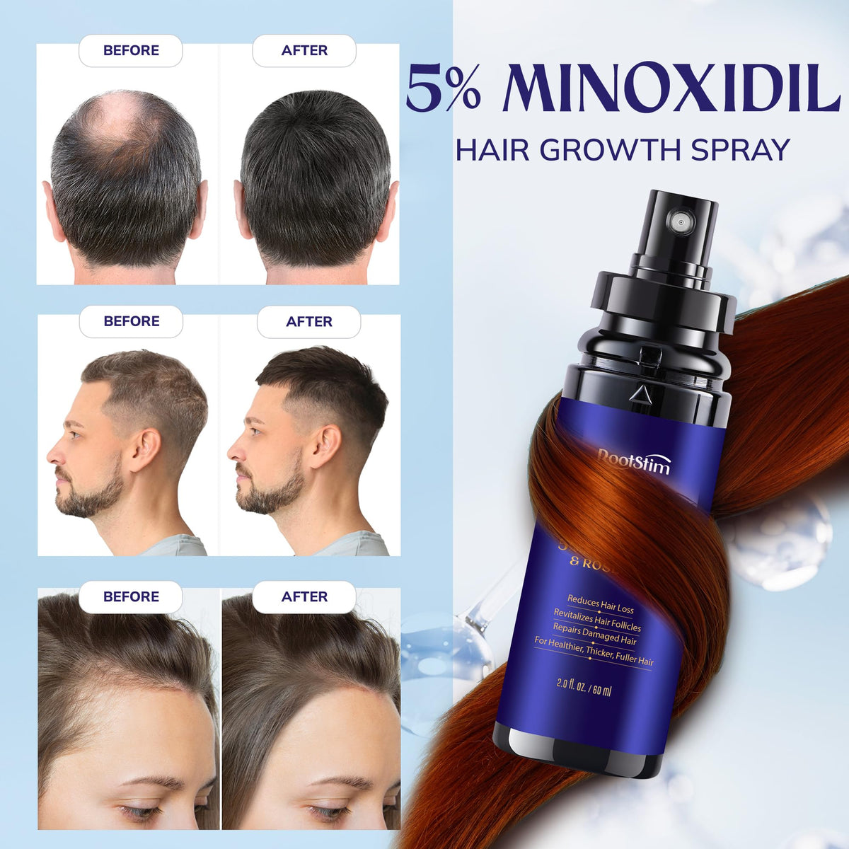 RootStim dropper applying serum to scalp demonstrating targeted treatment benefit