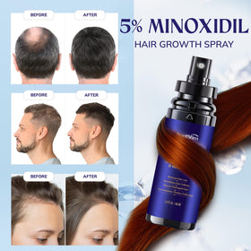 RootStim dropper applying serum to scalp demonstrating targeted treatment benefit