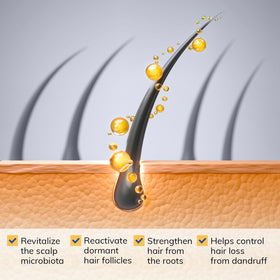 Person applying RootStim shampoo in shower for itch relief