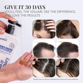 Lathered RootStim shampoo foam in hand illustrating gentle cleansing
