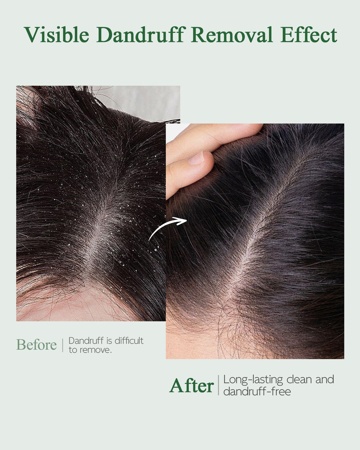 Ropink being applied to scalp with brush to remove buildup and improve absorption
