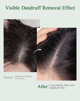 Ropink being applied to scalp with brush to remove buildup and improve absorption