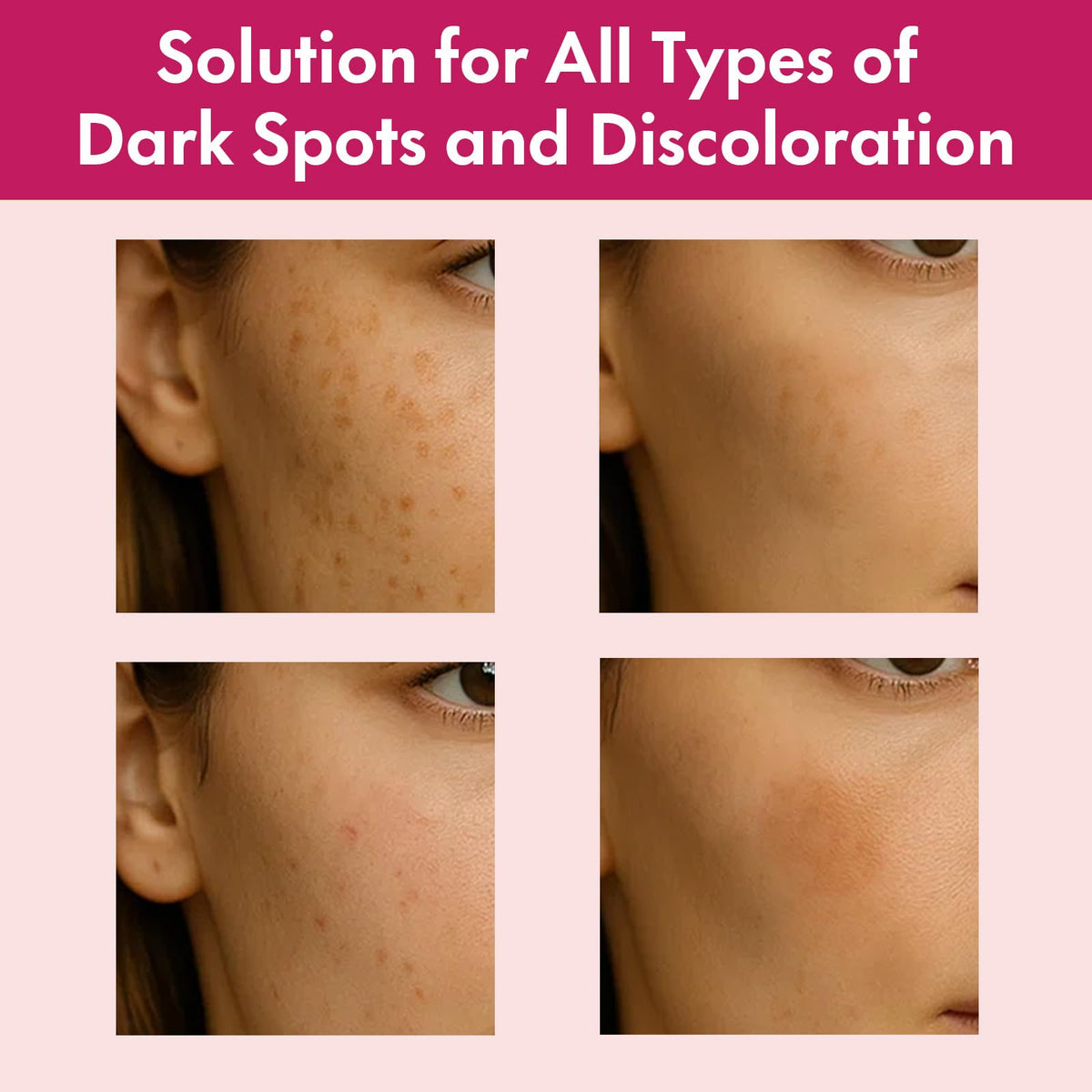 Roseblem hand applying cream highlighting smooth spreadability benefit
