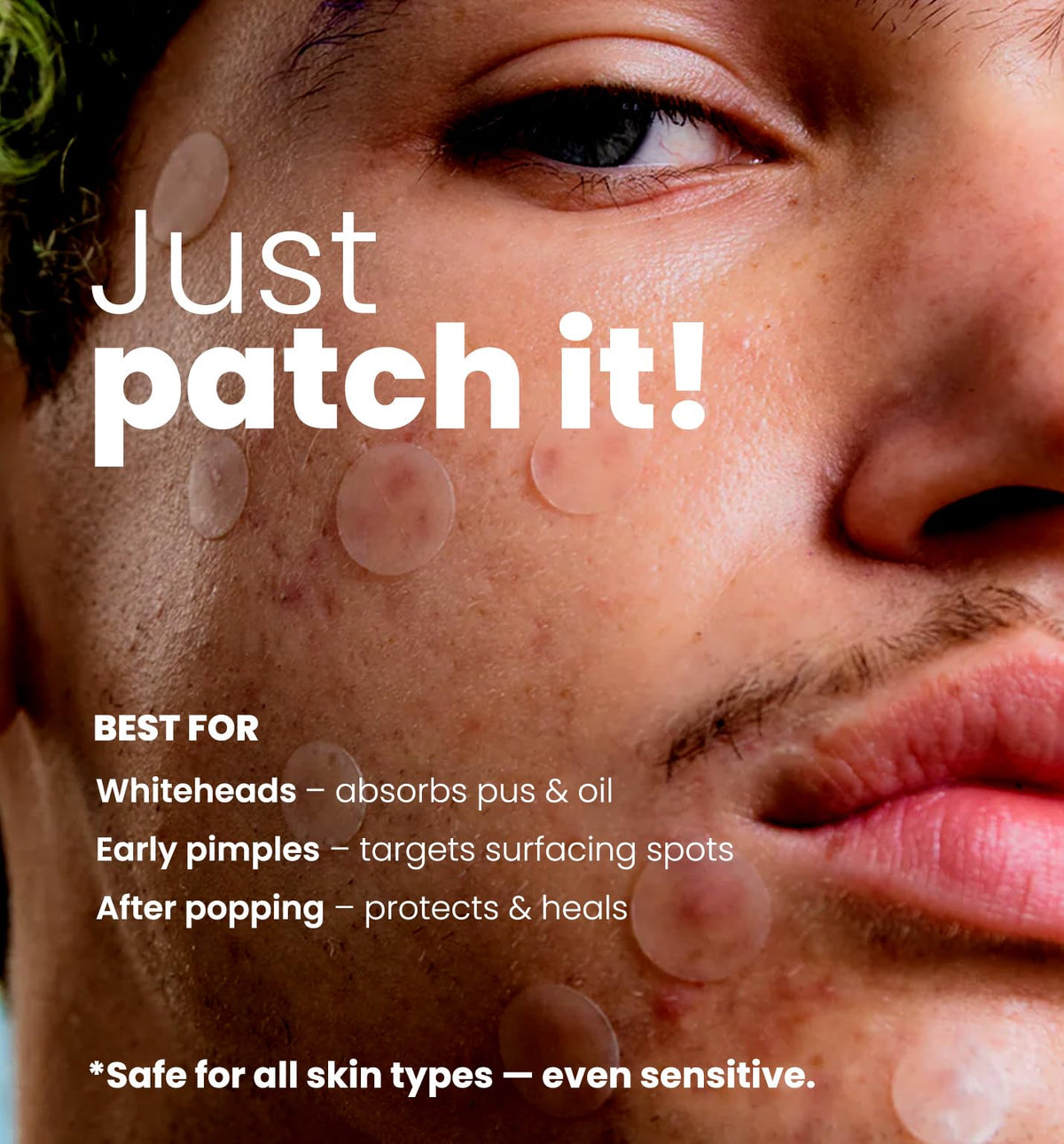 ROSELYNBOUTIQUE patch on cheek while sleeping indicating overnight protection