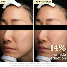 Model applying Rothea cream to face and neck demonstrating even application and hydration