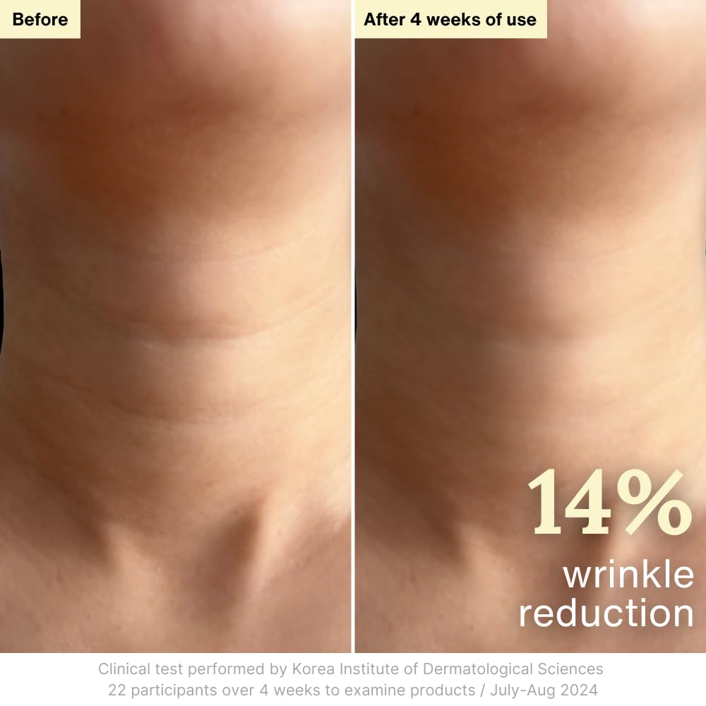 Demonstration of Rothea cream absorbing quickly into skin to show non-greasy finish