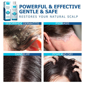 roycederm applied in shower demonstrating scalp massage and coverage benefit