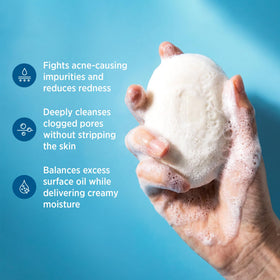 Roycederm soap bar close-up texture highlighting gentle exfoliation