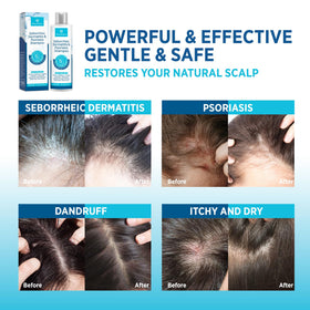 Roycederm bottle label details highlighting ingredients and usage directions for clarity